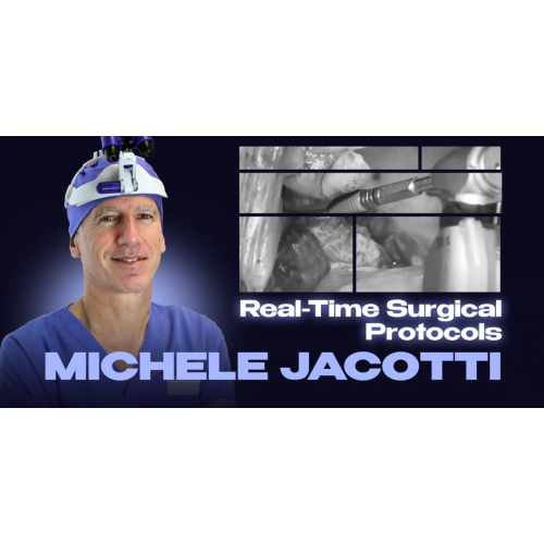 Real-Time Surgical Protocols: Sinus Lift, GBR, and Implant Placement. Step-by-Step Demonstrations from A to Z (Videos)