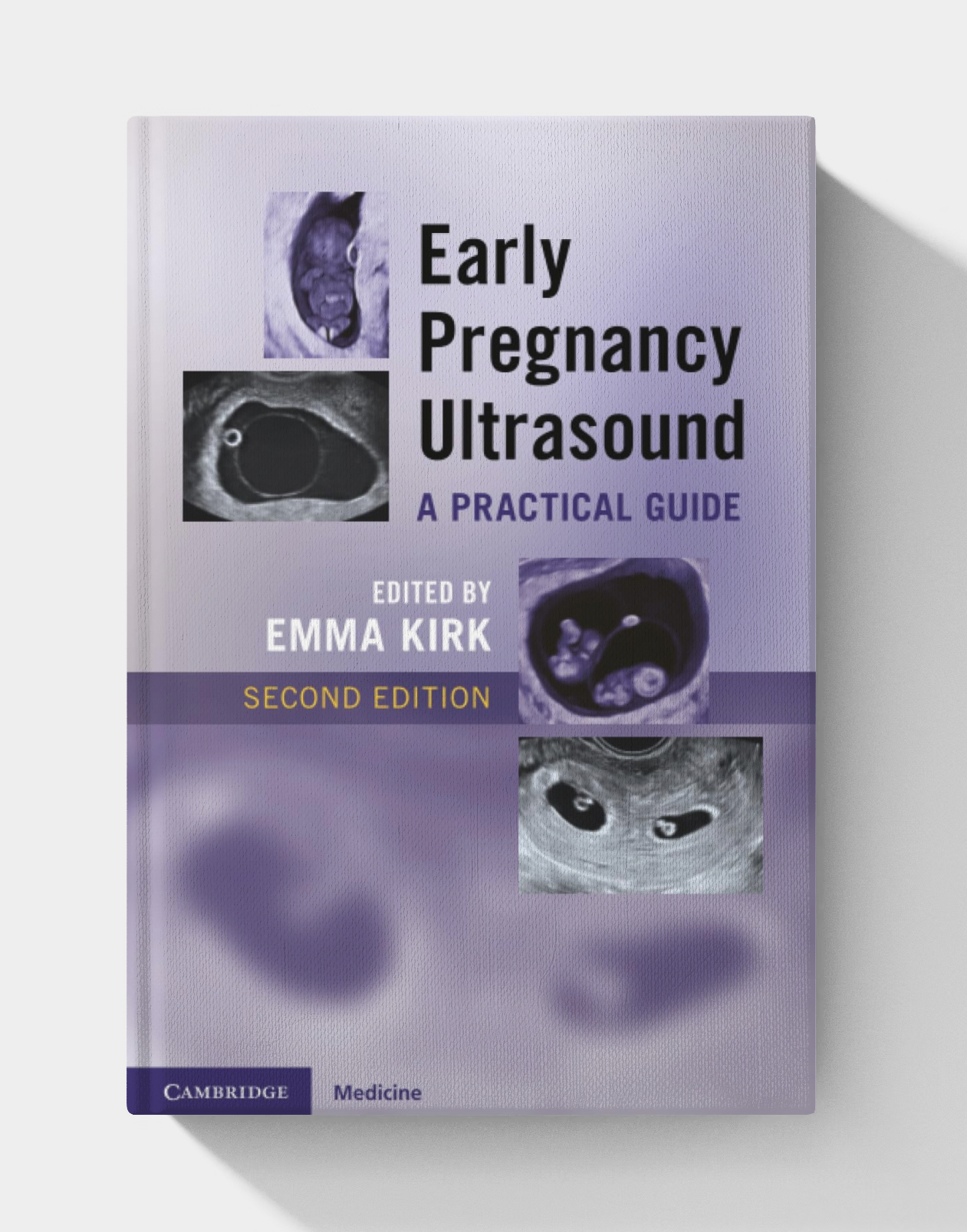 Early Pregnancy Ultrasound: A Practical Guide (2nd edition)