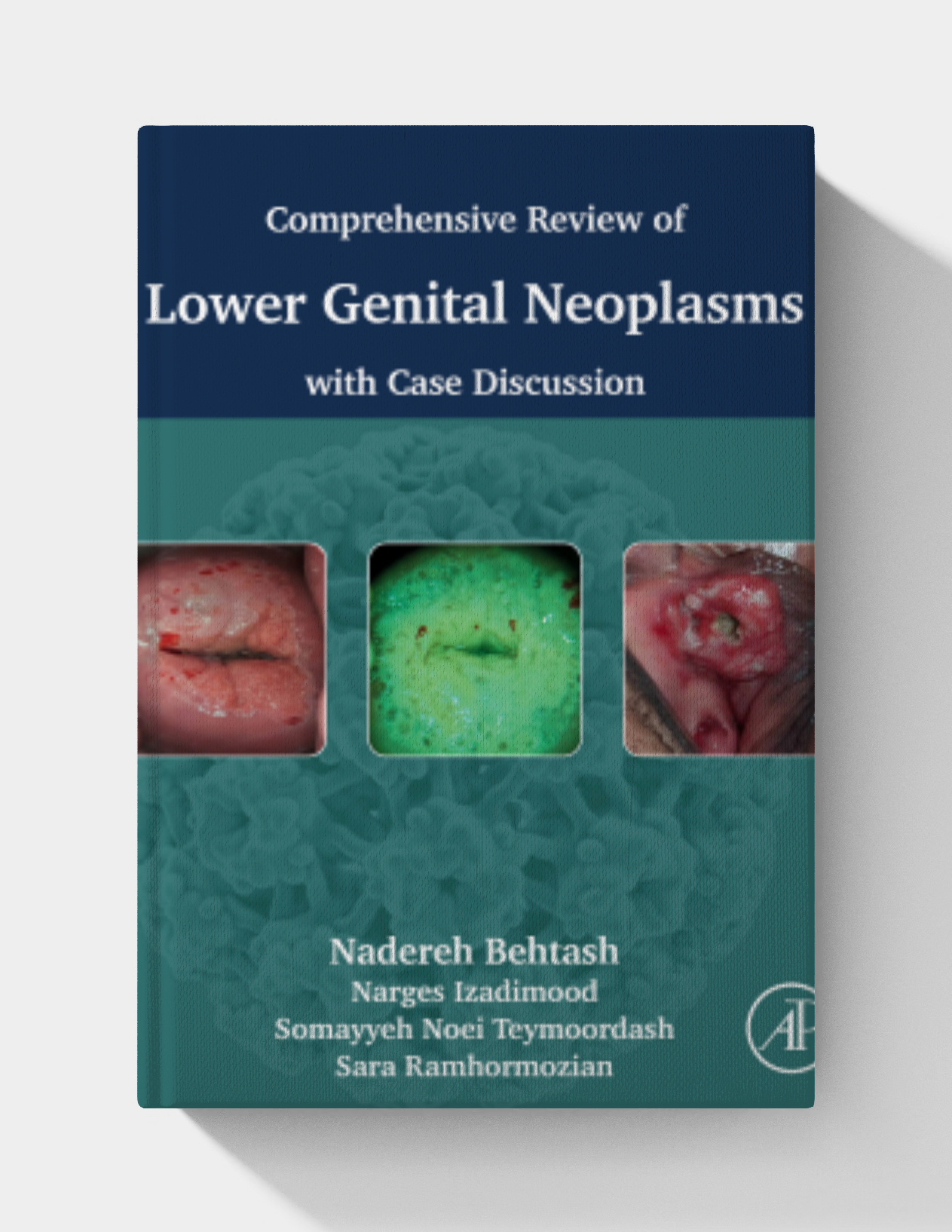 Comprehensive review of lower genital neoplasms: With case discussion (True PDF from Publisher)