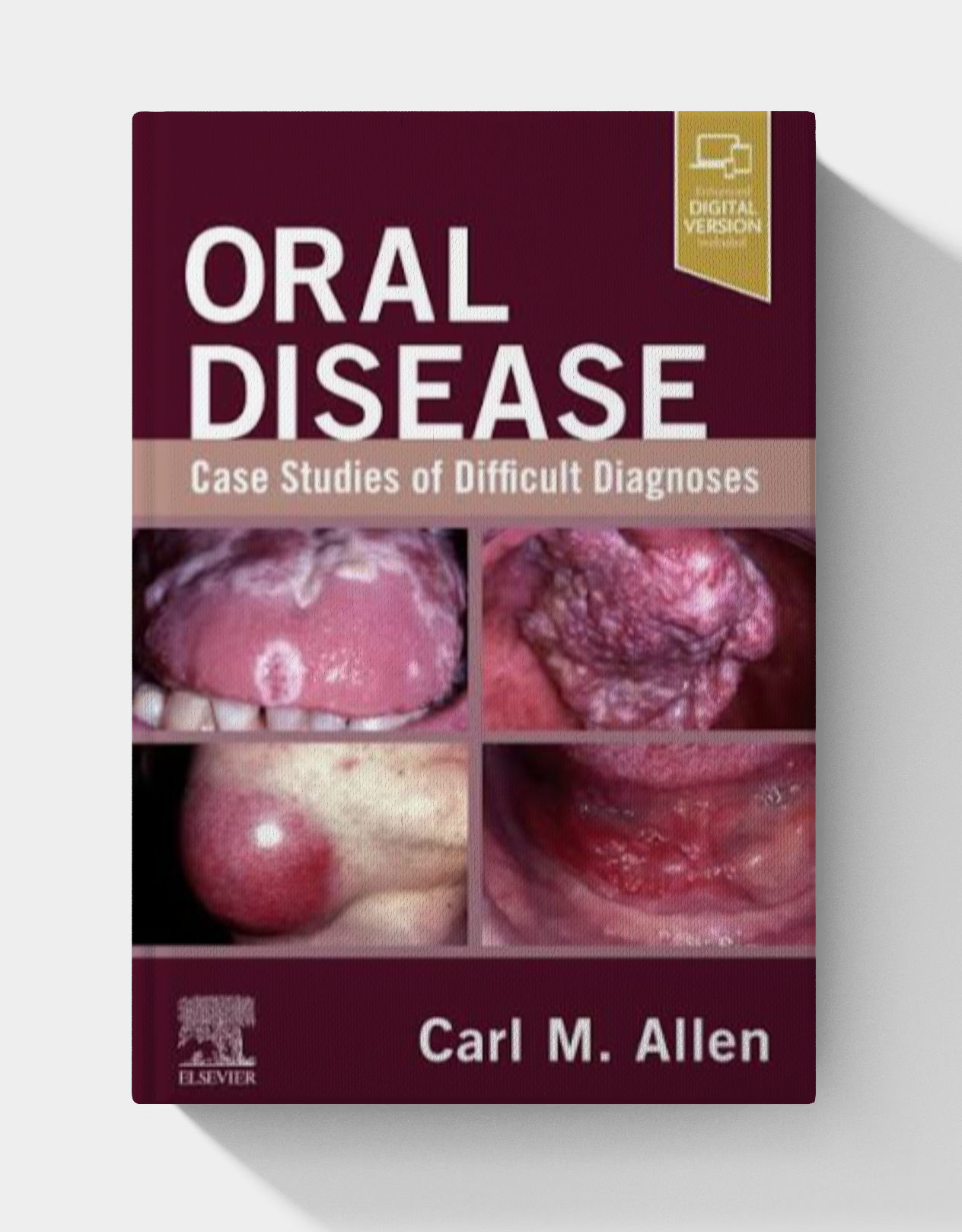 Oral Disease: Case Studies of Difficult Diagnoses (EPUB)