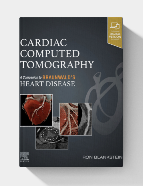 Cardiac Computed Tomography: A Companion to Braunwald’s Heart Disease
