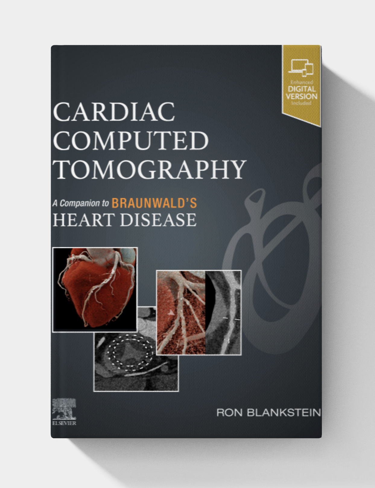 Cardiac Computed Tomography: A Companion to Braunwald’s Heart Disease