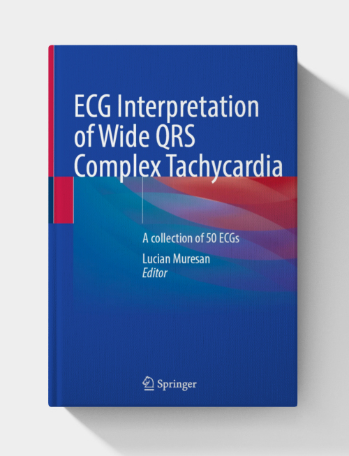 Interpretation of Wide QRS Complex Tachycardias: a collection of 50 ECGS