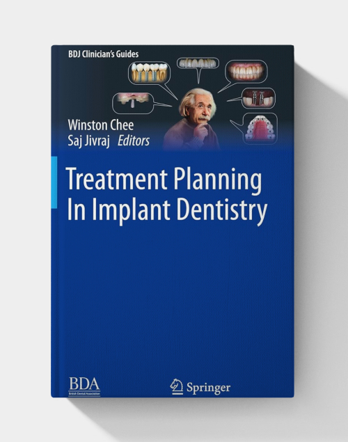 Treatment Planning In Implant Dentistry (BDJ Clinician’s Guides), 2nd edition