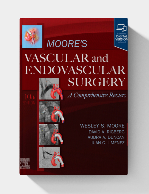 Moore’s Vascular and Endovascular Surgery: A Comprehensive Review, 10th edition